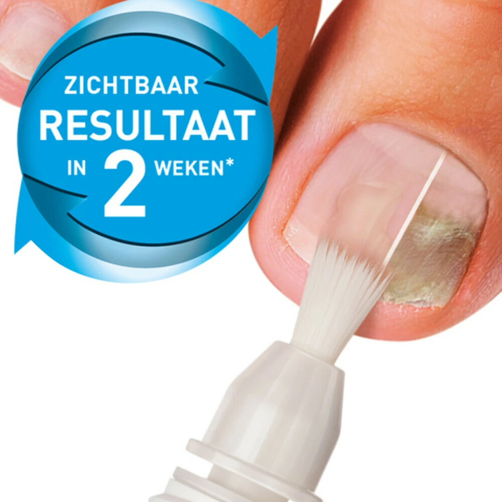 Mycosan Behandelset Kalknagel 3 Mycosan Behandelset Kalknagel - Afbeelding 3